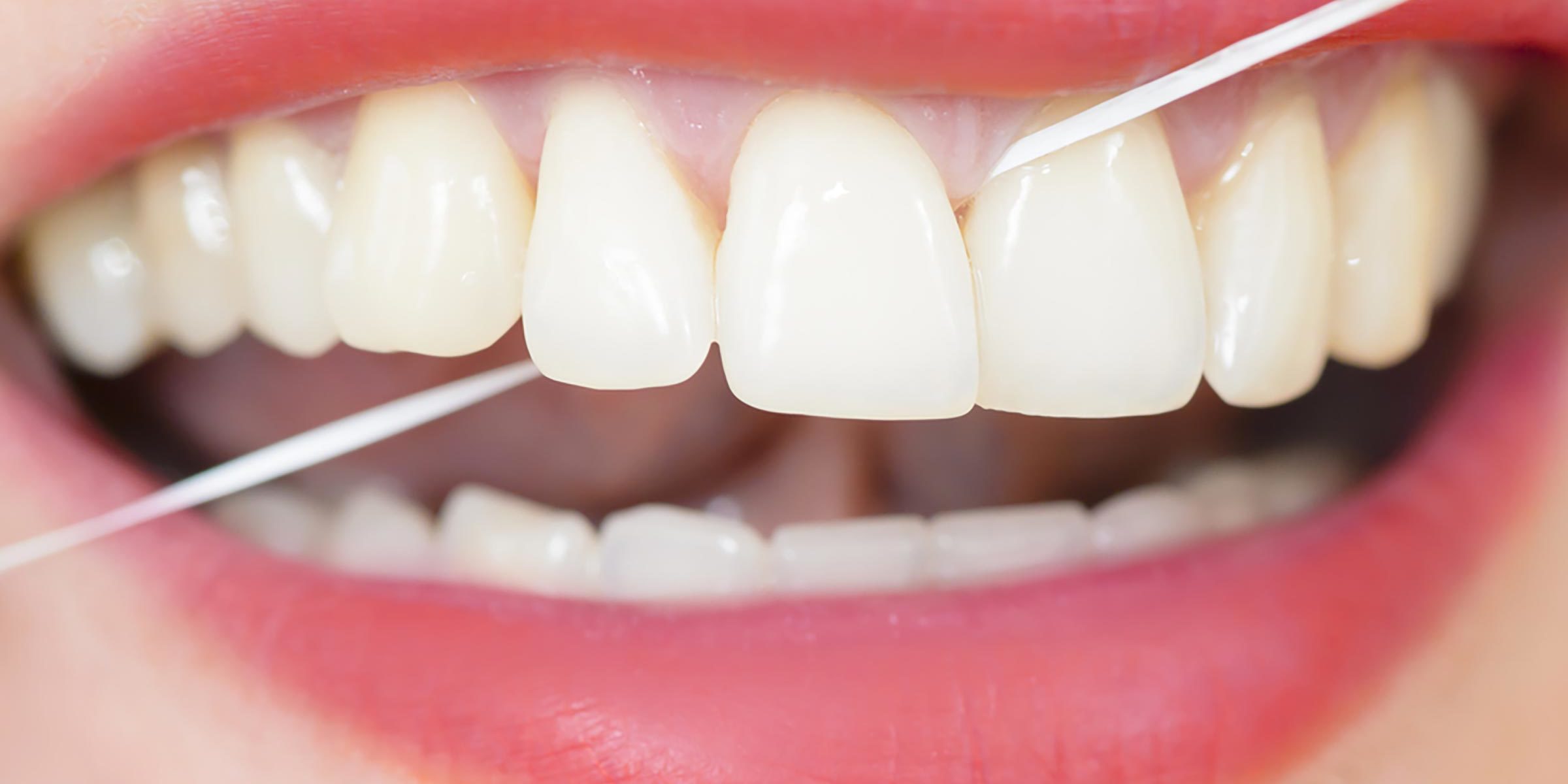 denstiste-conseils-soin-dentaire